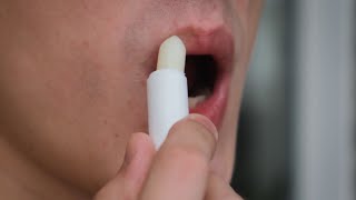 Doctor outlines keys to preventing chapped lips this winter [upl. by Nosidam]