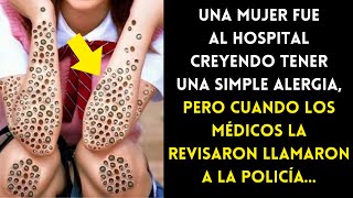 Mujer Fue Al Hospital Creyendo Tener Una Simple Alergia Médicos Al Revisarla Llamaron A La Policía [upl. by Imled]