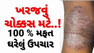 ખરજવું મટાડવા માટે  Eczema ka ilaj kharajvuDesiUpcharGujaratihelthtips GujaratiAyurvedicUpchar [upl. by Minta]