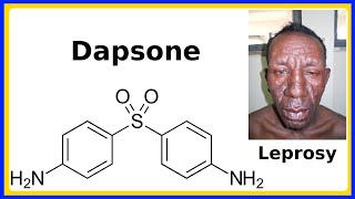 dapsone [upl. by Riabuz106]