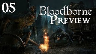 BLOODBORNE PREVIEW ► 05  KirkhammerBlunderbuss vs Cleric Beast  Lets Play BloodborneLPDE [upl. by Brick489]