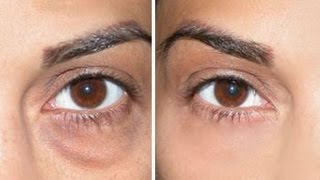 How to Cover Dark Circles  Under Eye Bags [upl. by Eanwahs]