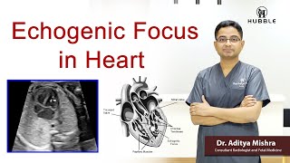 Echogenic Focus in Heart [upl. by Orferd]