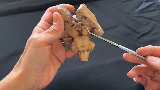 Brainstem Anatomy on 3D printed model [upl. by Araihc]