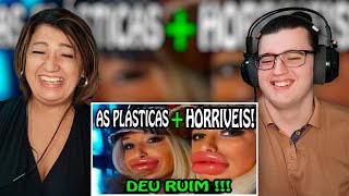 🔴 Plásticas Terríveis As Plásticas dos famosos que deram errado PARTE 1 FaladeTudo REACT [upl. by Nnayar]