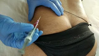 IM Intra Mascular INJECTION techniqueðŸ’‰ðŸ’‰ðŸ’‰ GLUTEAL MUSCLEðŸ¤” t [upl. by Ofilia451]