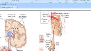 hemiplegia p1 [upl. by Lairbag924]