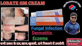 Lobate Gm Cream Useful in Eczema DermatitisItching And Fungal Infection Also [upl. by Rind]