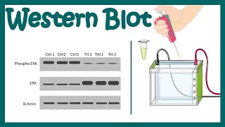 Western blot  Western blotting protocol  Application of Western Blot  Limitations of Western blot [upl. by Ecnar]