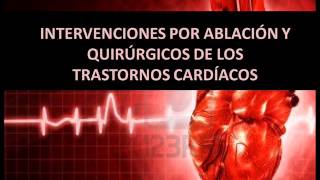 Intervenciones por ablación y quirúrgicos  Trastornos cardíacos [upl. by Persis]