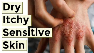 8 Things to Avoid With Eczema and Dry Itchy or Sensitive Skin [upl. by Ecerehs]