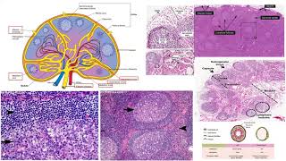 Pathology Made EasySystemic Pathology 8Blood Diseases5 [upl. by Skyla637]