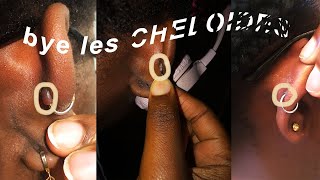 ✏︎ Comment en finir avec les chéloïdes  Gennys [upl. by Kelvin]