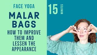 Face Yoga to Improve Malar Bags Eye Bags and Puffiness [upl. by Kyl]