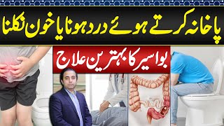 Piles Symptoms and Treatment  Bawaseer Ka Ilaj or Alamat  Symptoms and Treatment of Hemorrhoids [upl. by Ruscio]