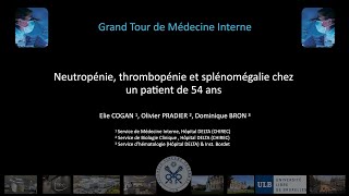 Neutropénie thrombopénie et splénomégalie chez un patient de 54 ans [upl. by Papageno]