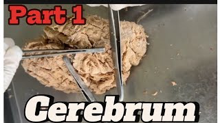 Gyri and sulci of cerebrum part 1 mbbsanatomy nepalforyou viral medicalhacks [upl. by Ahrendt24]