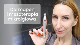 MEZOTERAPIA MIKROIGŁOWA W TWOIM DOMU [upl. by Chrissy]