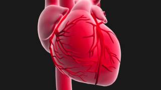 Questce quun infarctus du myocarde [upl. by Milburt]