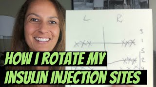 How I Rotate My Insulin Injection Sites [upl. by Charmain214]