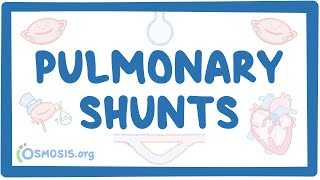 Pulmonary shunts [upl. by Evante]