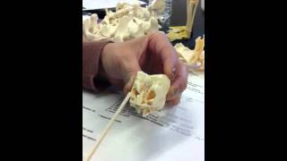 Ethmoid sinus bone model in anatomy [upl. by Wailoo]