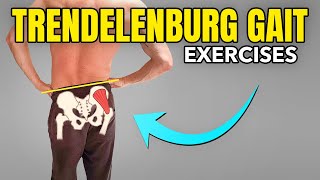 3 Exercises to Correct a Trendelenburg Gait Pattern [upl. by Rabah410]