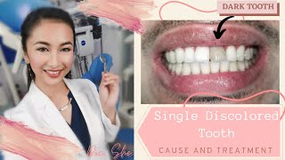 How to treat a discolored or dark tooth  zirconia crown [upl. by Ettesyl]