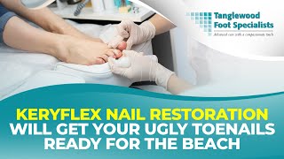 Keryflex Nail Restoration Will Get Your Ugly Toenails Ready for The Beach [upl. by Campbell342]