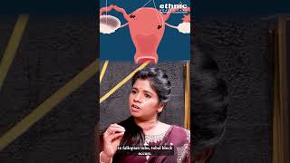 PCOS இருந்தால் குழந்தை பிறக்காதா  தீர்வு என்ன  Dr BYoga Vidhya [upl. by Outlaw987]