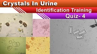 Crystals In Urine Identification Training Quiz  Part 45 [upl. by Anawat]