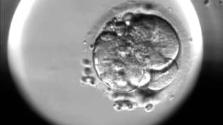 Timelapse of fertilisation of a human egg under the microscope [upl. by Ehtyaf8]