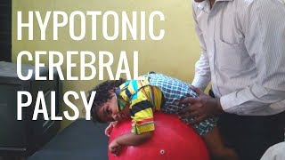 Hypotonic Cerebral Palsy Home Tips amp Physiotherapy [upl. by Strickland]