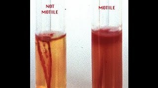 Motility Determination in Bacteria  Amrita University [upl. by Ravo]