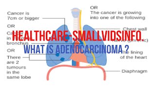 What is Adenocarcinoma  Metastatic Adenocarcinoma Life Expectancy [upl. by Farrand]