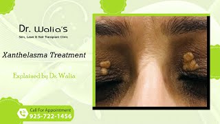 Xanthelasma I Xanthelasma Treatment I Dr Walias Skin and Hair Transplant Clinic [upl. by Peppi]