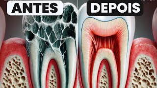 Dente Latejando Depois da Restauração Saiba o Que Pode Estar Acontecendo [upl. by Peh]