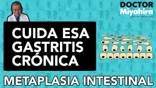 💣METAPLASIA INTESTINAL cuida esa GASTRITIS CRÓNICA 😱¿QUÉ ES y cuáles son los TIPOS DE METAPLASIA [upl. by Nahtan]