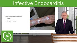 Infective Endocarditis IE Definition amp Epidemiology– Infectious Diseases  Lecturio [upl. by Niwle135]