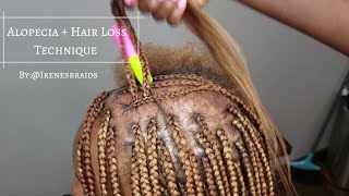 NEW TECHNIQUE ALOPECIA  HAIR LOSS BOX BRAIDS  IRENESBRAIDS [upl. by Ylera367]