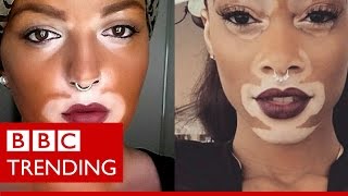 Winnie Harlow  The model whos bringing vitiligo into the open  BBC Trending [upl. by Labotsirhc]