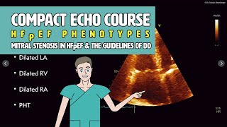 〖Echocardiography〗 HFpEF amp mitral stenosis amp DD Guidelines 💜 [upl. by Flosi]