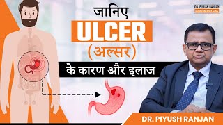 जानिए Ulcer अल्सर क्यों होता है और इलाज क्या है  Duodenal and Gastric Ulcers Treatment [upl. by Wilterdink477]