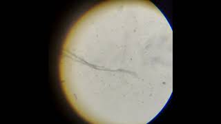 Human Sperm under the microscope lab shortvideo [upl. by Eilesor580]