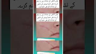 contractubex gel benefits facecare facecream shortsvideo [upl. by Meehar]