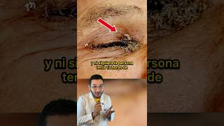 Arroz en el ojo 👁️🍚😱 [upl. by Slaohcin]