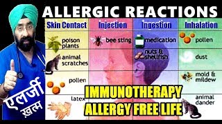 Skin allergy in hindi urticariaपित्ती शीतपत्ति causesfood and other allergen Dr Gaurav patel [upl. by Aciretahs]