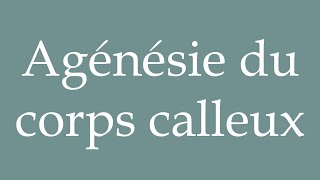 How to Pronounce Agénésie du corps calleux Agenesis of the corpus callosum in French [upl. by Oirretno]