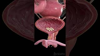 🪨 Bladder Stones What You Need to Know 🪨 anatomy [upl. by Ark51]