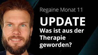 Regaine Monat 11  Was ist aus der Regaine Therapie geworden [upl. by Roehm]